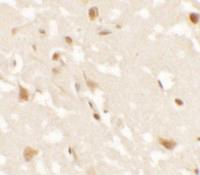 Anti-AIG1 Rabbit Polyclonal Antibody