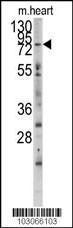 Anti-MYLK3 Rabbit Polyclonal Antibody (APC (Allophycocyanin))