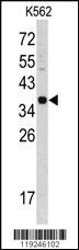 Anti-CTSE Rabbit Polyclonal Antibody