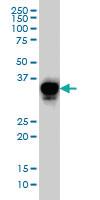 Anti-CRX Mouse Monoclonal Antibody [clone: 4G11]