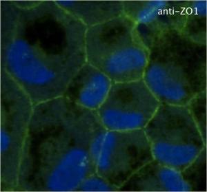 Anti-ZO1 antibody