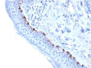 Immunohistochemical analysis of formalin-fixed, paraffin-embedded human skin using Anti-TRP1 Antibody [TYRP1/3284]