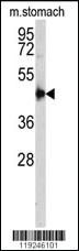 Anti-CTSE Rabbit Polyclonal Antibody