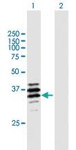 Anti-PPT2 Mouse Polyclonal Antibody