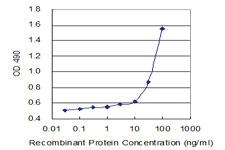 Anti-IGKC Polyclonal Antibody Pair