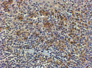 Anti-MYD88 Antibody (A82548) (4µg/ml) staining of paraffin embedded Human Tonsil. Steamed antigen retrieval with Tris/EDTA buffer pH 9, HRP-staining. These results could not been obtained after antigen retireval at pH6 with this batch of antibody.