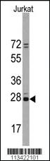 Anti-RHEB Rabbit Polyclonal Antibody