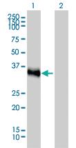 Anti-CRX Mouse Monoclonal Antibody [clone: 4G11]