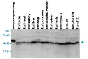 Anti-P4HB Rabbit Polyclonal Antibody