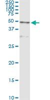 Anti-CTSD Antibody Pair