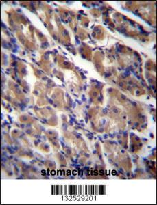 Anti-ABRA Rabbit Polyclonal Antibody (HRP (Horseradish Peroxidase))