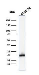 Western blot analysis of COLO-38 cell lysate using Anti-MelanA Antibody