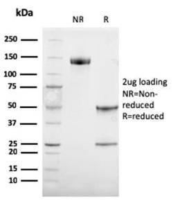 SDS-PAGE analysis of Anti-TRP1 Antibody [TYRP1/3284] under non-reduced and reduced conditions; showing intact IgG and intact heavy and light chains, respectively. SDS-PAGE analysis confirms the integrity and purity of the antibody