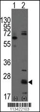 Anti-RHEB Rabbit Polyclonal Antibody