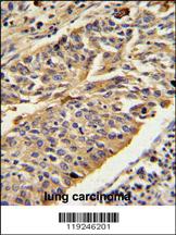 Anti-CTSE Rabbit Polyclonal Antibody