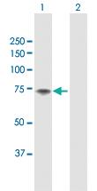 Anti-F11 Rabbit Polyclonal Antibody