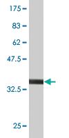 Anti-PPOX Mouse Monoclonal Antibody [clone: 1E1]