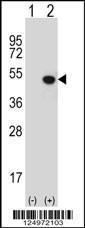 Anti-KDM8 Rabbit Polyclonal Antibody (Biotin)