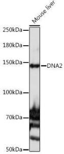 Western blot analysis of extracts of Mouse liver, using Anti-DNA2 Antibody (A10681) at 1:1,000 dilution. The secondary antibody was Goat Anti-Rabbit IgG H&L Antibody (HRP) at 1:10,000 dilution.