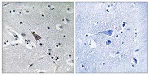 Immunohistochemical analysis of paraffin-embedded human brain using Anti-SLC6A16 Antibody. The right hand panel represents a negative control, where the antibody was pre-incubated with the immunising peptide.