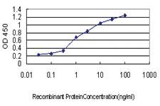 Anti-CRX Mouse Monoclonal Antibody [clone: 4G11]