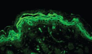 Anti-ERK1 + ERK2 Polyclonal Antibody