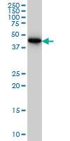 Anti-CRTAP Mouse Monoclonal Antibody [clone: 4D9]