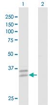 Anti-PPT2 Rabbit Polyclonal Antibody