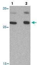 Anti-AIG1 Rabbit Polyclonal Antibody