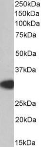 Anti-MYD88 Antibody (A82548) staining (0.2µg/ml) of Human Thymus lysate (RIPA buffer, 35µg total protein per lane). Primary incubated for 1 hour. Detected by chemiluminescence.