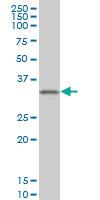 Anti-CRX Mouse Monoclonal Antibody [clone: 2F12]