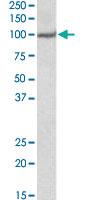 Anti-USP4 Goat Polyclonal Antibody