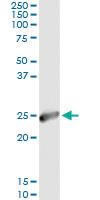 Anti-IGKC Antibody Pair