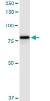 Anti-F13A1 Polyclonal Antibody Pair