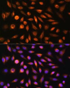 Immunofluorescence analysis of L929 cells using Anti-SH3PXD2A Antibody (A10684) at a dilution of 1:100. DAPI was used to stain the cell nuclei (blue).