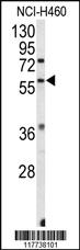 Anti-ESRRB Rabbit Polyclonal Antibody