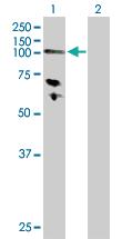 Anti-HK3 Rabbit Polyclonal Antibody