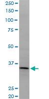 Anti-LDB3 Mouse Monoclonal Antibody [clone: 2C1]