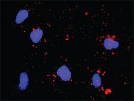 Anti-CDK7 + E2F1 Antibody Pair