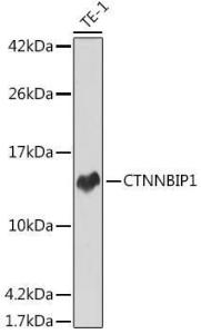 Western blot analysis of extracts of TE-1 cells, using Anti-CTNNBIP1 / ICAT Antibody [ARC2551] (A307577) at 1:1,000 dilution. The secondary antibody was Goat Anti-Rabbit IgG H&L Antibody (HRP) at 1:10,000 dilution.