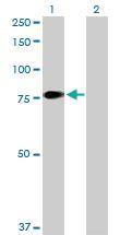 Anti-F11 Rabbit Polyclonal Antibody