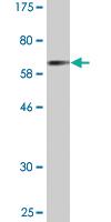 Anti-CTSE Mouse Monoclonal Antibody [clone: 2D5]