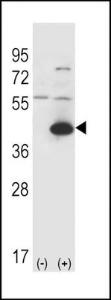 Anti-GOT1 Rabbit Polyclonal Antibody (FITC (Fluorescein Isothiocyanate))