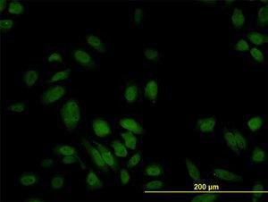 Anti-Calcyclin Mouse Monoclonal Antibody [clone: 6B5]