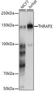 Western blot analysis of extracts of various cell lines, using Anti-TR150 Antibody (A10691) at 1:500 dilution. The secondary antibody was Goat Anti-Rabbit IgG H&L Antibody (HRP) at 1:10,000 dilution.