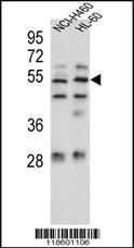 Anti-Sestrin-1 Rabbit Polyclonal Antibody