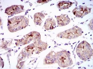 Anti-Myosin, Cardiac, Heavy Chain Mouse Monoclonal Antibody [clone: 8L880]