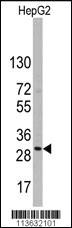 Anti-CD9 Rabbit Polyclonal Antibody