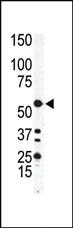 Anti-ILK1/ILK2 Rabbit Polyclonal Antibody