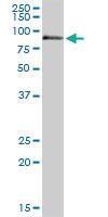 Anti-F11 Rabbit Polyclonal Antibody